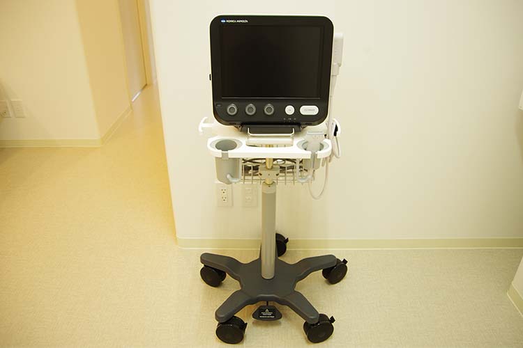 超音波診断装置